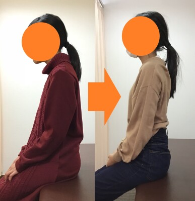 東大阪　整体　スマホ首