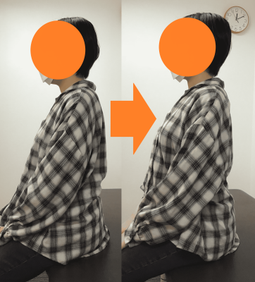 東大阪　整体　巻き肩