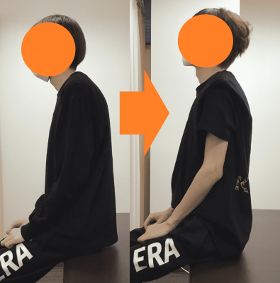 東大阪　整体　猫背　背中の痛み