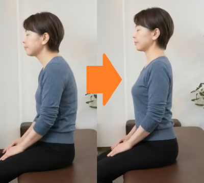 東大阪　整体　巻き肩　1