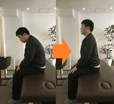 東大阪　整体　永和　猫背　疲労感　１