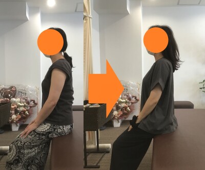 40代女性　巻き肩　肩こり　猫背矯正